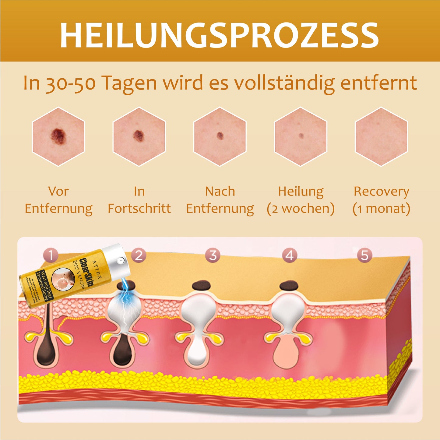 ReineHaut Bienengift Warzen und Hautmarkenentfernungs Spray 2