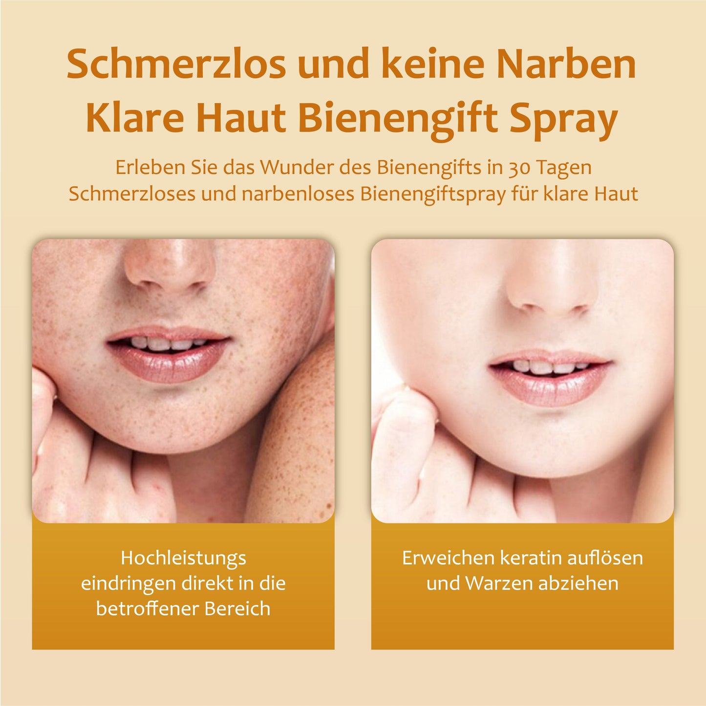 ReineHaut Bienengift Warzen und Hautmarkenentfernungs Spray 2